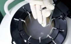 冷冻精子和新鲜精子做试管，谁更有优势？