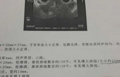 优势卵泡变小后做阴超如何判断是萎缩了还是已经排了？