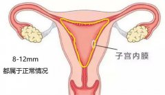 子宫内膜为17mm，可进行美国试管婴儿囊胚移植吗？