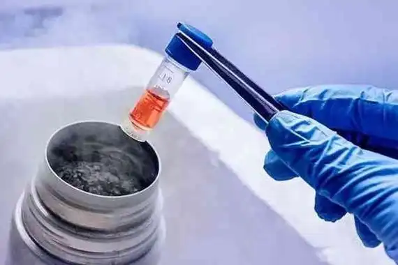 未婚做试管合法的国家有哪些?附相关费用一览表分享