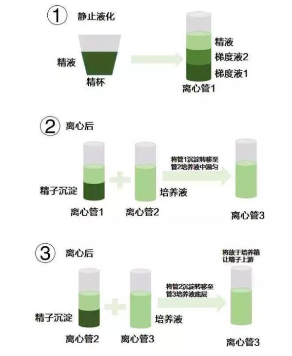 HIV洗精术具体流程