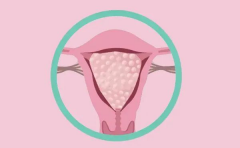 思普乐HRC：赴美做试管婴儿，如何避免葡萄胎？