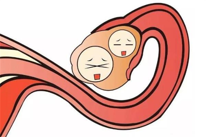 卵子不健康