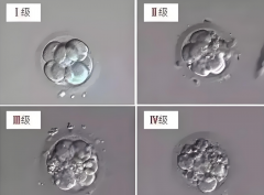 试管婴儿胚胎质量不好是什么引起的?